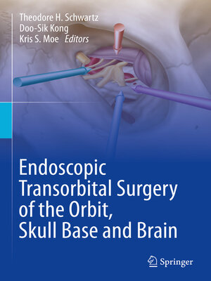 cover image of Endoscopic Transorbital Surgery of the Orbit, Skull Base and Brain